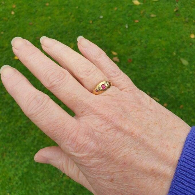 Edwardian Ruby and Diamond Ring in 18ct gold.